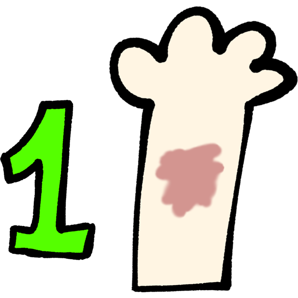 A pale white arm with a green 1 next to it. The arm has a pale red blotch on it.